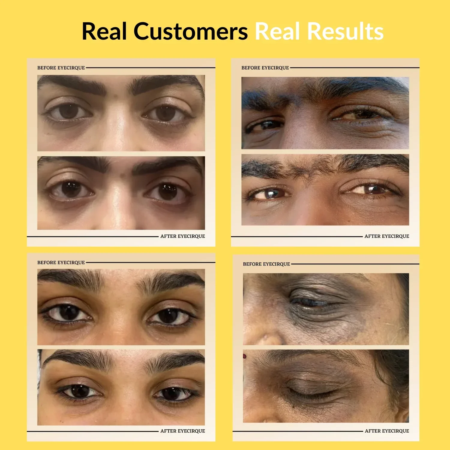 Eyecirque ADVANCE Under Eye Gel Serum (30 g) - Image 5